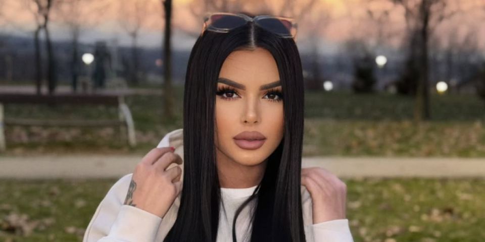 Šta joj se dogodilo s licem? Anita Stanojlović ne liči na sebe! (FOTO)